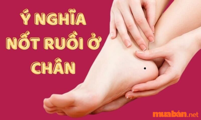 Nốt ruồi bàn chân