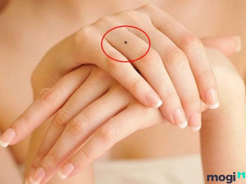 Nốt ruồi ngón tay giữa ở nữu