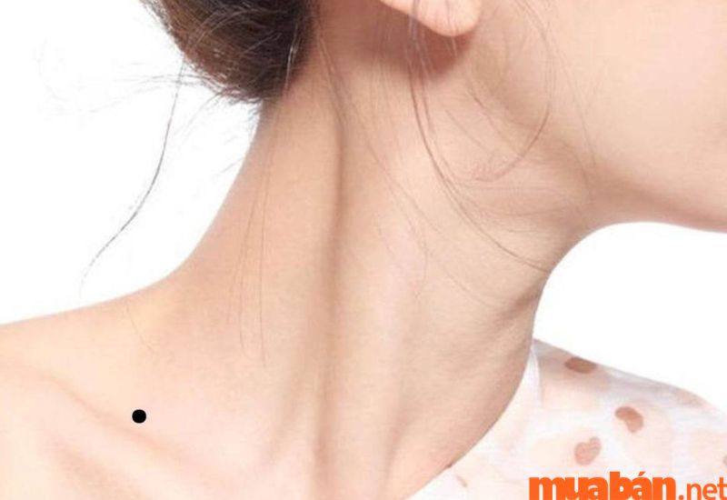 nốt ruồi trên cổ