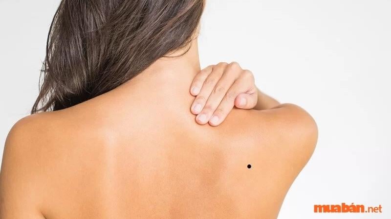 Ý nghĩa nốt ruồi sau vai nam và nữ