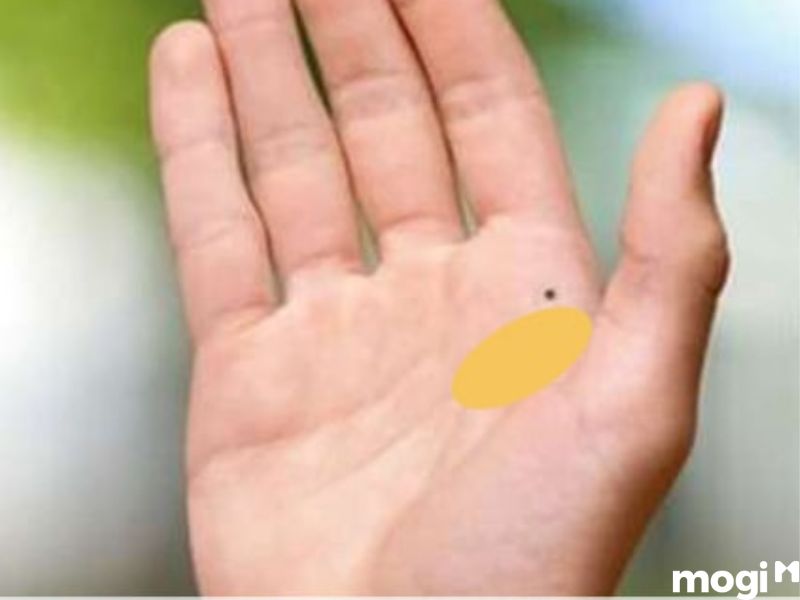 Nốt ruồi trong lòng bàn tay gò hỏa tinh dương