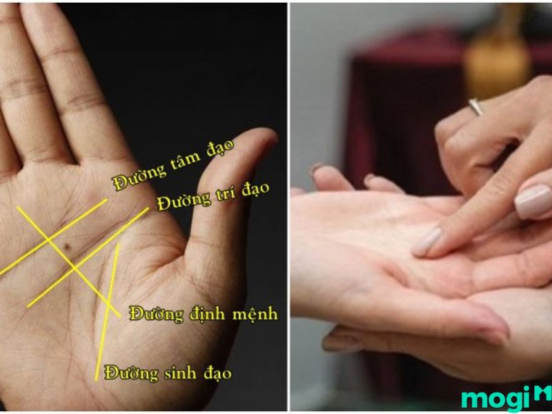 Nốt ruồi trong lòng bàn tay theo đường chỉ đạo