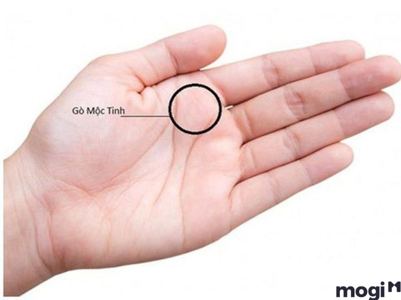 Nốt ruồi trong lòng bàn tay gò mộc tinh