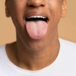 10 Enfermedades de la lengua: Principales problemas y cómo tratarlos