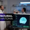 How do you Code and Bill for Subdural Hematoma?