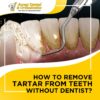 How To Remove Tartar From Teeth Without Dentist?