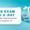 Tooth Extraction | Comprehensive Guide