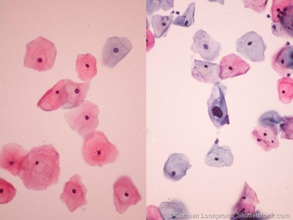 cytopath c/v auto fluid redo