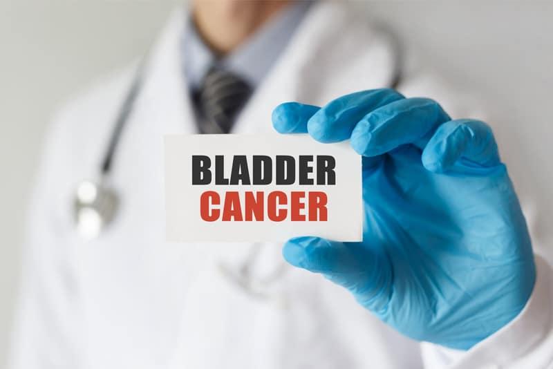 diagnosis code for bladder cancer