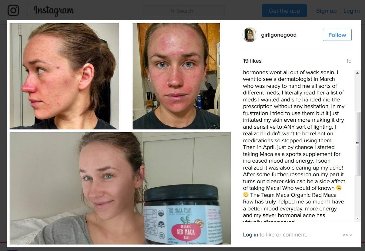 maca-for-hormonal-acne-themacateam.com.png