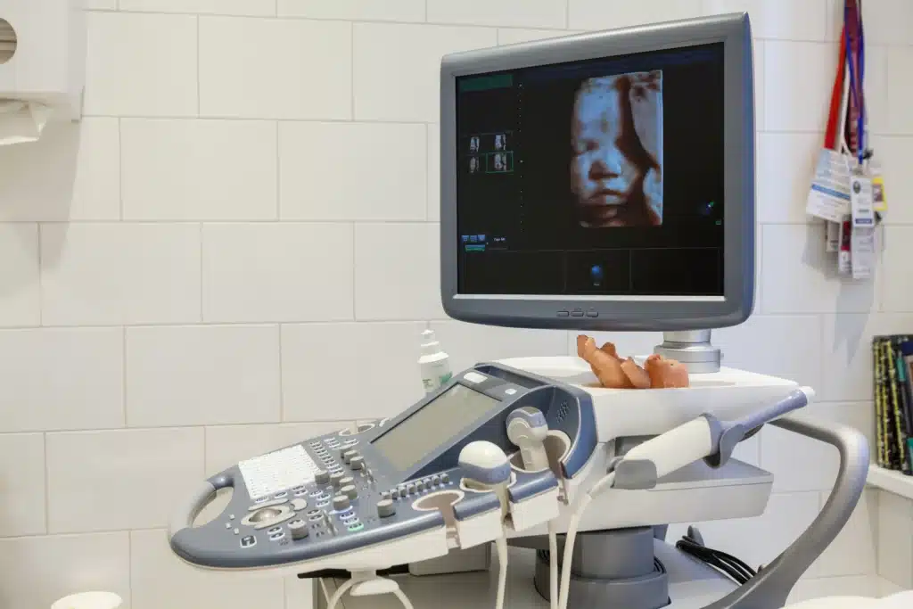 does planned parenthood offer ultrasounds