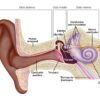 Infecciones del oído en los niños