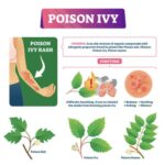 Your Complete Guide to Poison Ivy: How to Spot It, Prevent It & Treat It