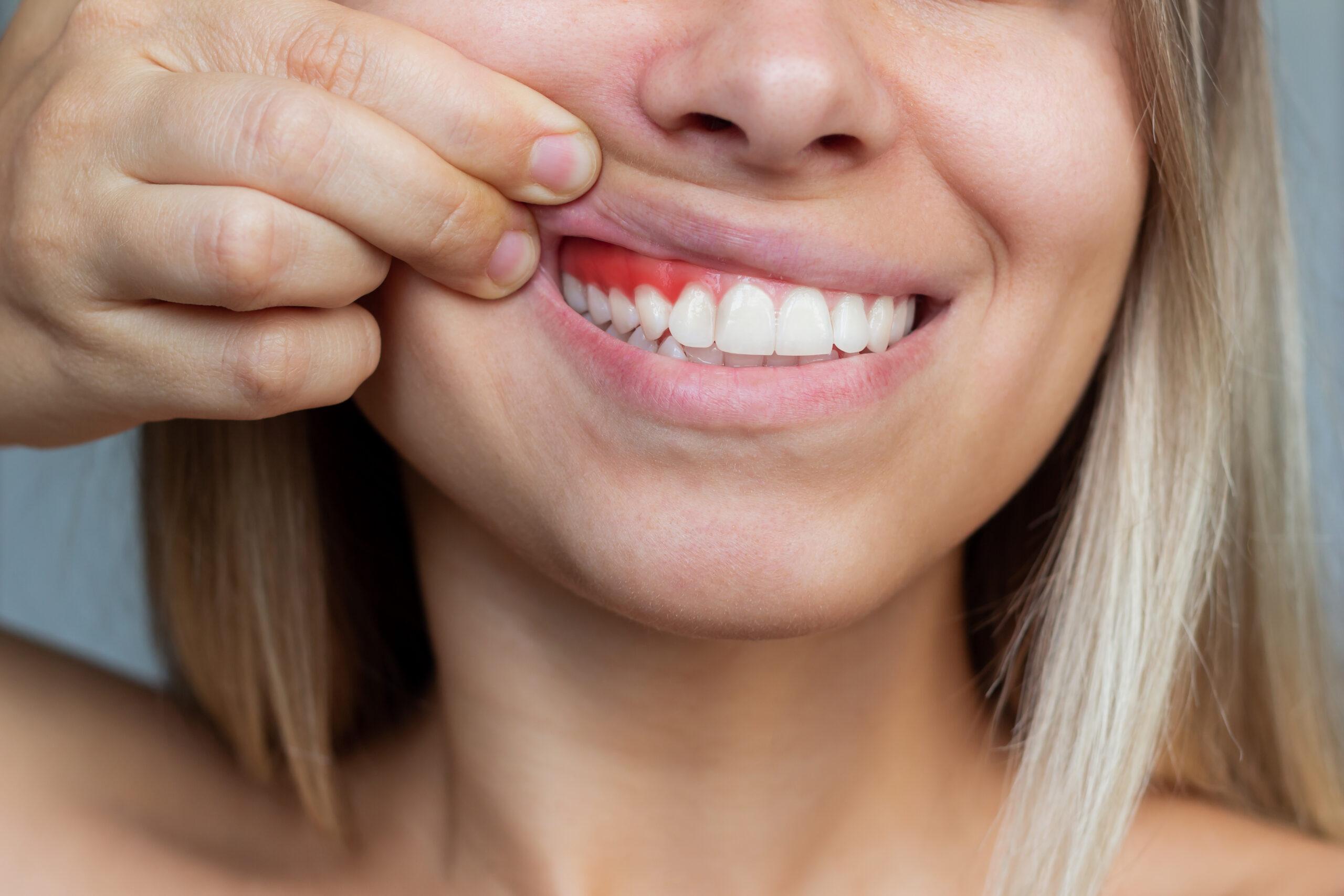 how long does it take gums to heal from a cut