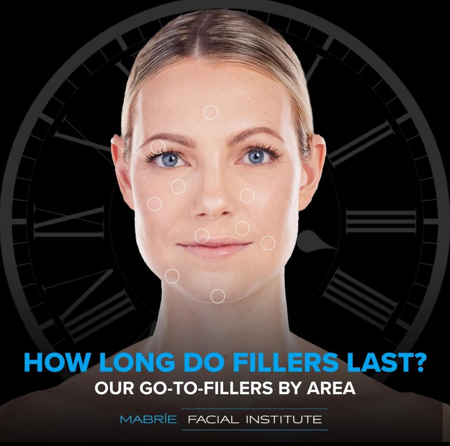 how long does nasolabial fold filler last