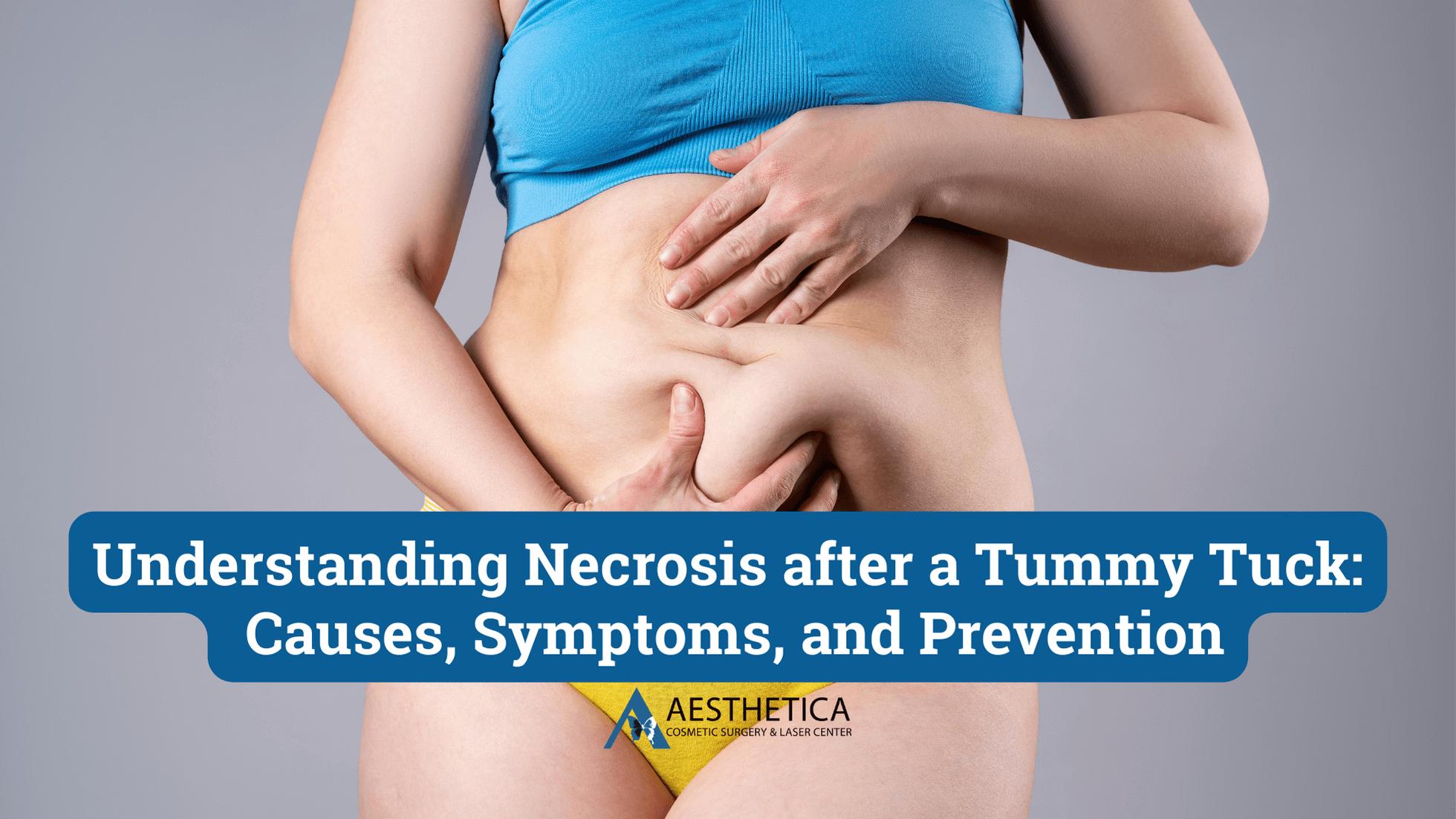 how to avoid necrosis after tummy tuck