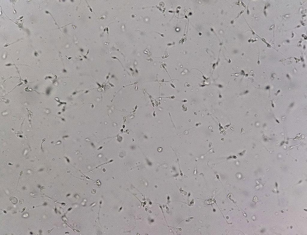 human sperm under microscope 400x