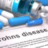 Documenting and Coding Crohn’s Disease – Key Considerations