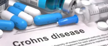 Documenting and Coding Crohn’s Disease – Key Considerations