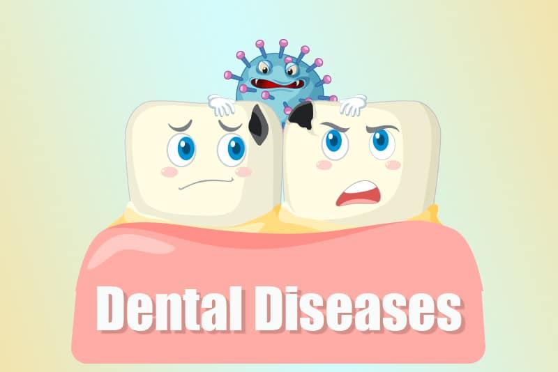 icd 10 code post nasal drip