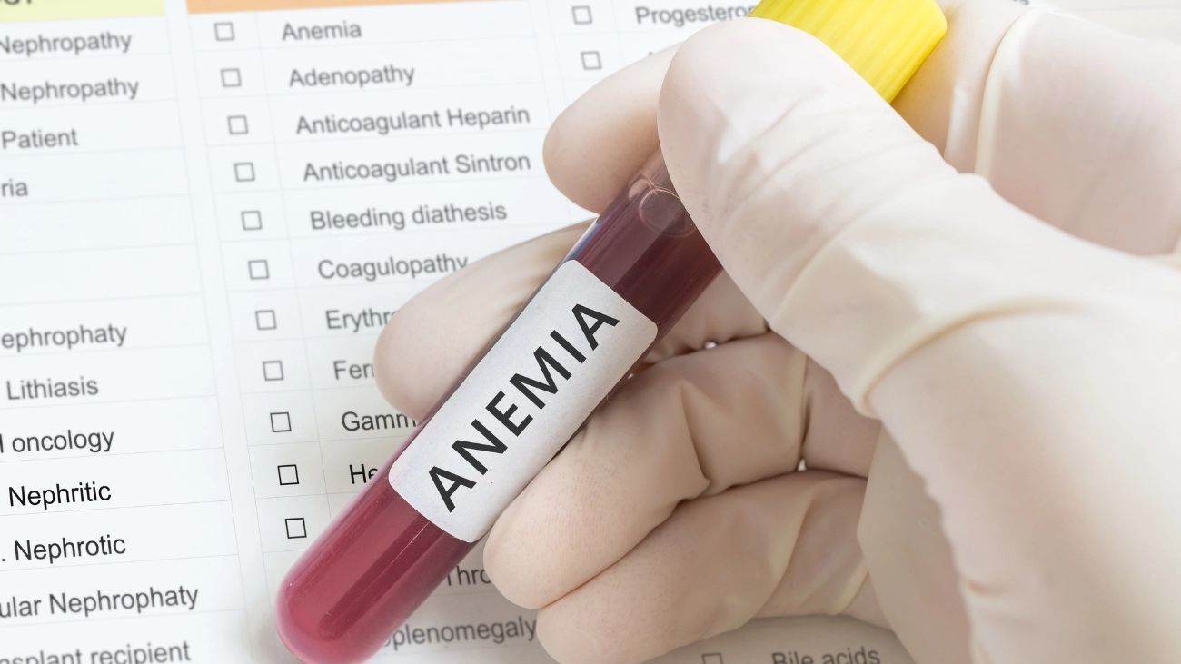 post hemorrhagic anemia icd 10