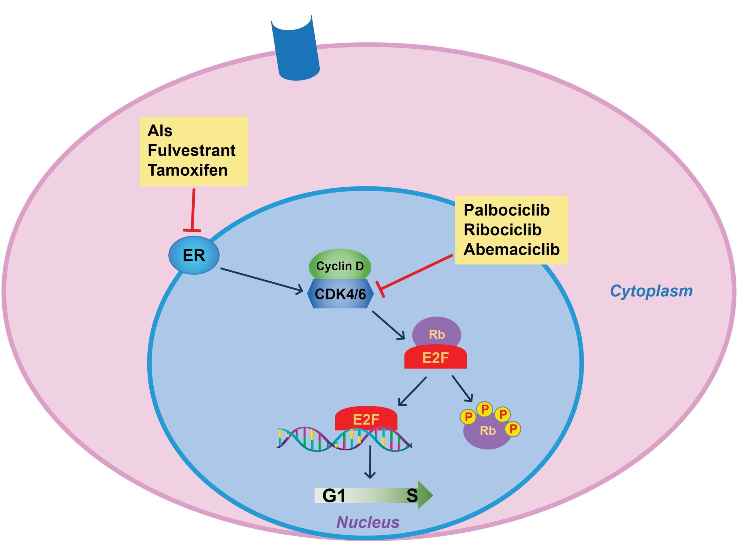 Combo of Ribociclib, Letrozole Improves Survival in Advanced Breast Cancer